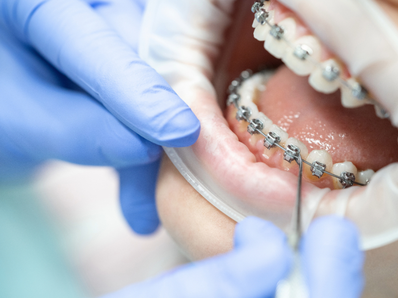Dentiste Taverny